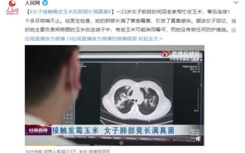 女子接触霉变玉米后肺部长满真菌及真菌感染肺部的症状