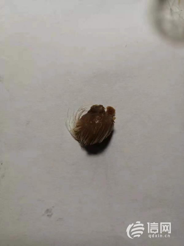 得利斯香肠吃出毛状异物 执法人员调解消费者得到赔偿
