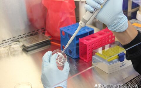 做亲子鉴定需要开证明吗及做亲子鉴定的手续和材料