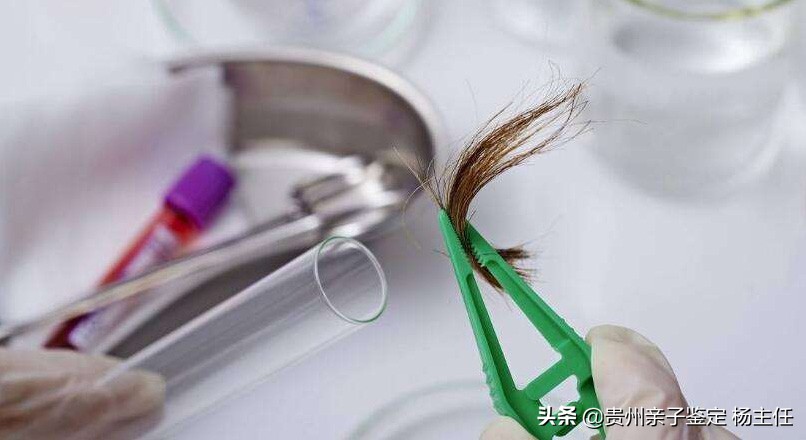 哪几种标本可以做亲子鉴定，做亲子鉴定用哪些样本最为准确？