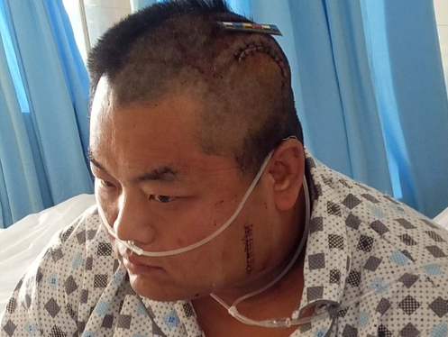 造成他人轻伤害后，主动赔偿金钱并获得谅解，检察院还会逮捕吗？