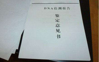 亲权鉴定是什么意思?亲权鉴定和亲子鉴定与DNA鉴定有什么区别
