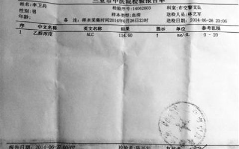 酒驾的标准是多少毫升