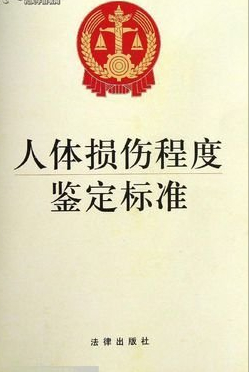 过失致人受伤或死亡，是否承担刑事责任？及需承担的民事赔偿责任