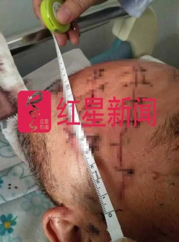 男子入室砍人被反打致死 法院:倒地后继续殴打,防卫过当